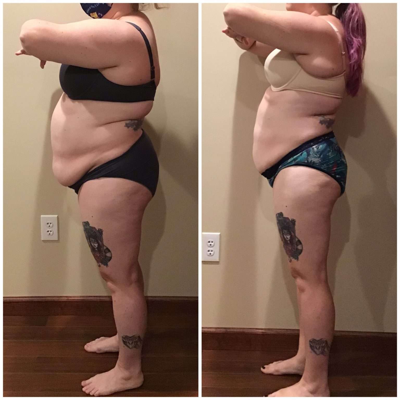 weight loss nutley nj Weight Loss with Body Contouring Plan