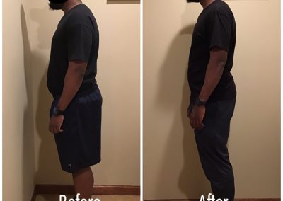 Caldwell Weight Loss Center