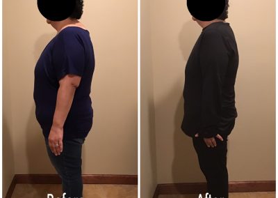 Little Falls Weight Loss Center
