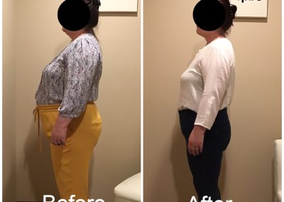 Essex County Weight Loss Center
