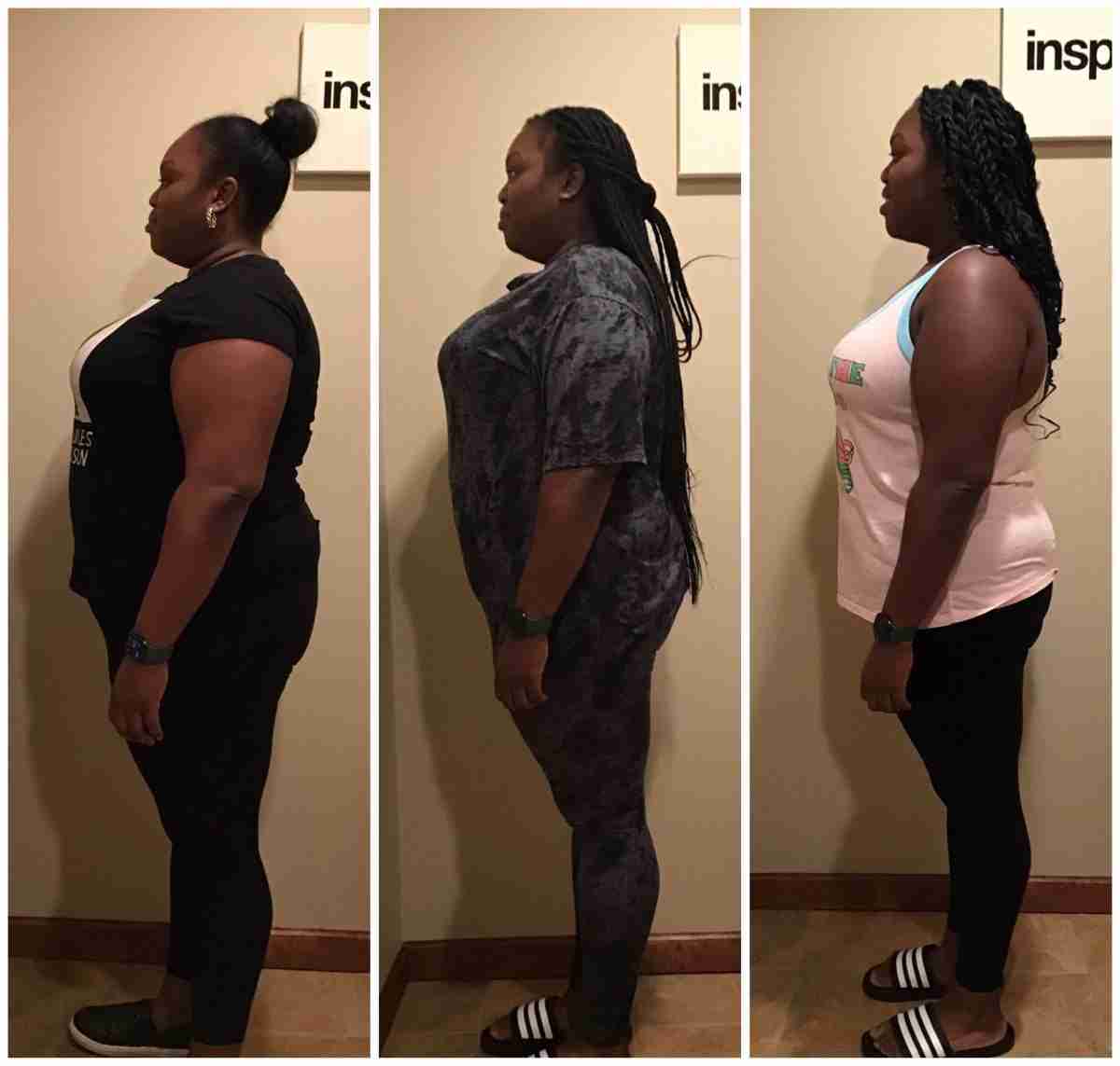 IE-Before-_-After-2nd-Round-2-scaled Upper Montclair Weight Loss Center