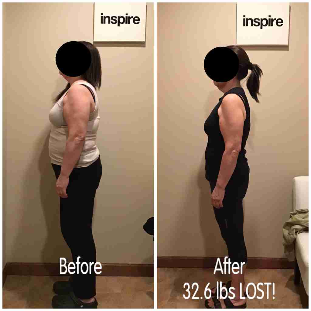 LP32.6 (1) Glen Ridge Weight Loss Center