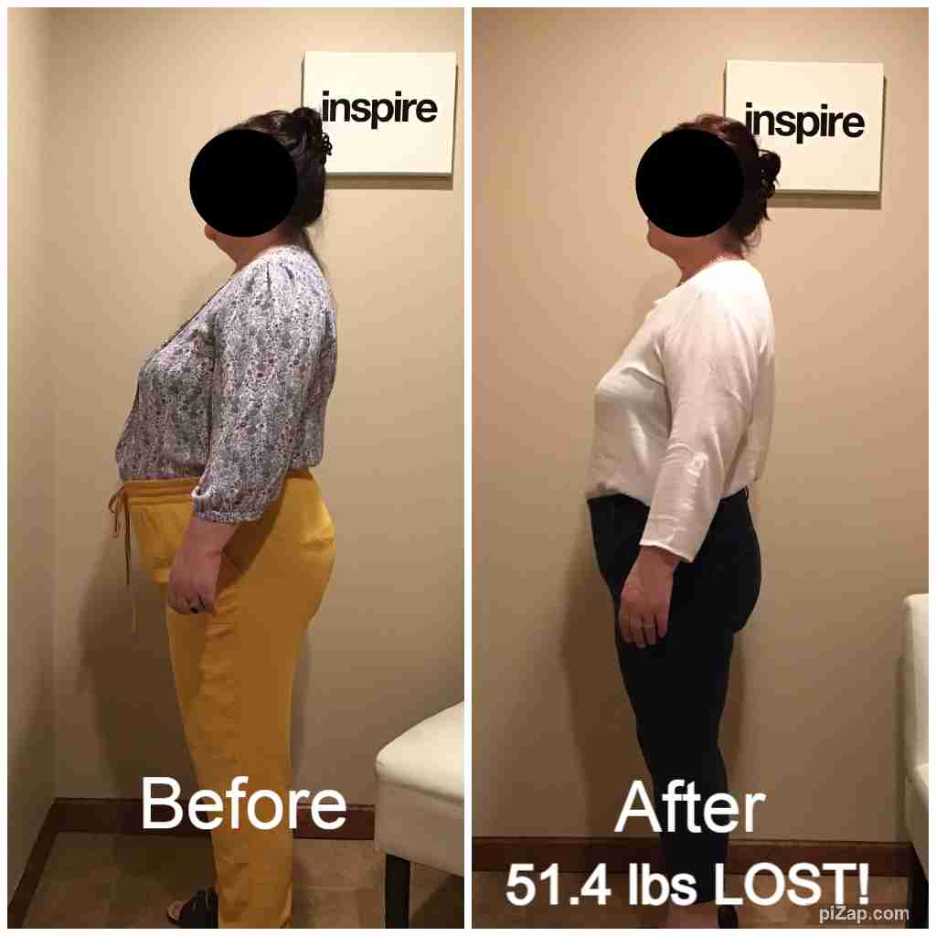 SA51.4 Nutley Weight Loss Center