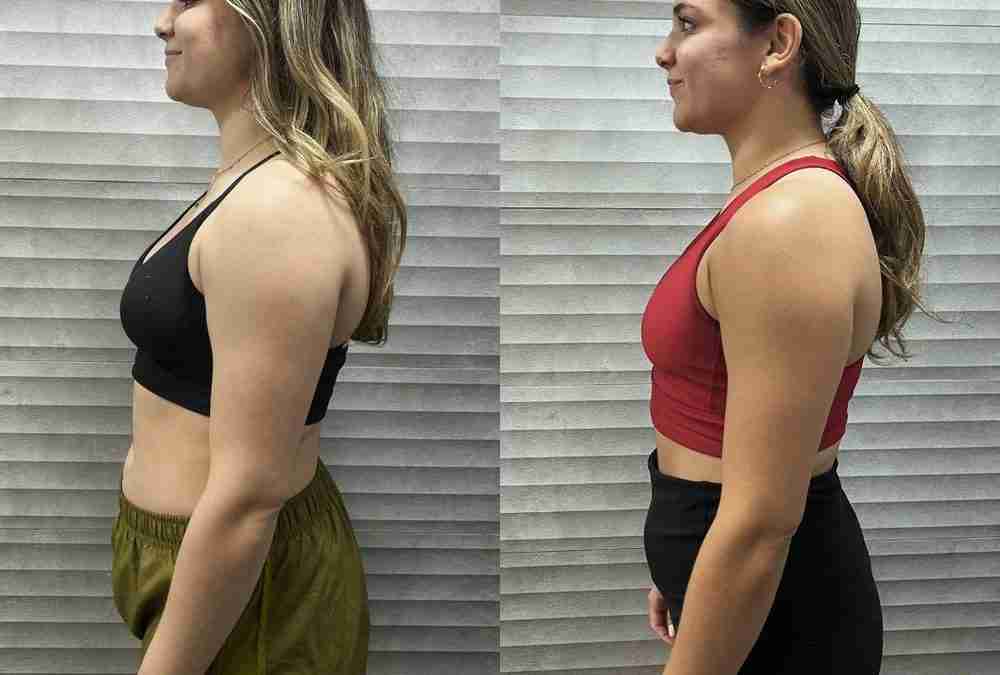 Transform Your Life with Inspire Weight Loss Nutley